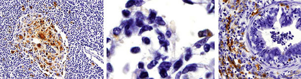 Đai thực bào được tìm thấy trong hạch bẹn, phế nang và dịch phù