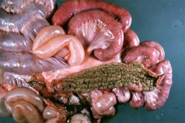 Ruột viêm hoại tử chất chứa trong ruột đen